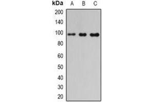 Western blot analysis of PDE6-beta expression in mouse pancreas (A), mouse heart (B), rat liver (C) whole cell lysates. (PDE6B 抗体)