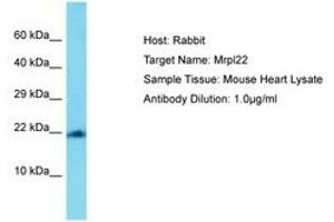 Image no. 1 for anti-Mitochondrial Ribosomal Protein L22 (MRPL22) (AA 108-157) antibody (ABIN6750490)