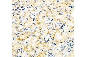 Immunohistochemistry (Paraffin-embedded Sections) (IHC (p)) image for anti-Cytochrome P450, Family 20, Subfamily A, Polypeptide 1 (CYP20A1) antibody (ABIN7073675)