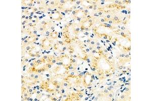 Immunohistochemistry of paraffin embedded mouse kidney using CYP20A1 (ABIN7073675) at dilution of 1: 700 (400x lens) (CYP20A1 抗体)