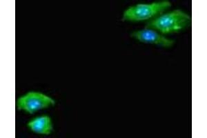 Immunofluorescent analysis of HepG2 cells using ABIN7146992 at dilution of 1:100 and Alexa Fluor 488-congugated AffiniPure Goat Anti-Rabbit IgG(H+L) (CTNND2 抗体  (AA 4-308))