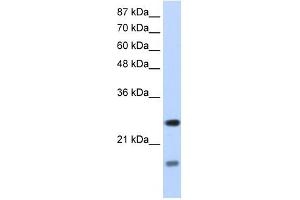 SRP14 antibody used at 1. (SRP14 抗体)
