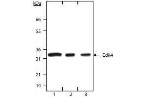 Western blot analysis of Cdk4. (CDK4 抗体  (N-Term))