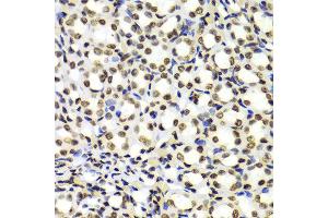 Immunohistochemistry (IHC) image for anti-Histone 3 (H3) (H3K4me) antibody (ABIN3023251)
