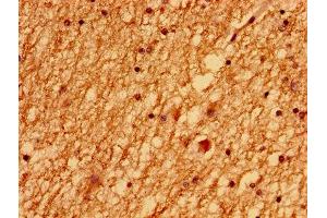 Immunohistochemistry of paraffin-embedded human brain tissue using ABIN7174184 at dilution of 1:100
