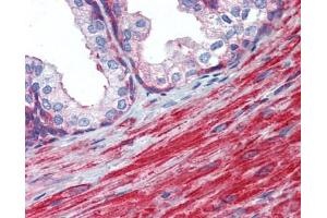 MYL6 antibody was used for immunohistochemistry at a concentration of 4-8 ug/ml.