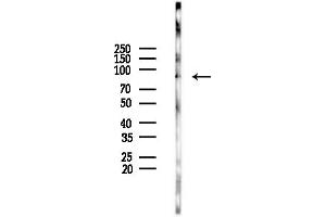 Western blot analysis of lysates from HepG2 cells(LPS,4h treatment), using BCL11A Antibody at 1/1000 dilution.