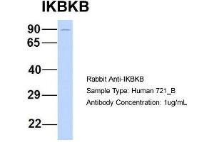 Host: Rabbit Target Name: IKBKB Sample Type: Human 721_B Antibody Dilution: 1. (IKBKB 抗体  (N-Term))