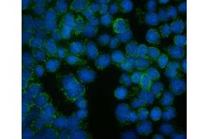 IF analysis of FRMD6 using anti-FRMD6 antibody (ABIN7599577). (FRMD6 抗体  (AA 1-95))