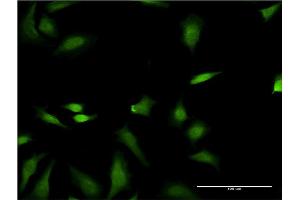 Immunofluorescence of monoclonal antibody to FNTB on HeLa cell. (FNTB 抗体  (AA 1-437))