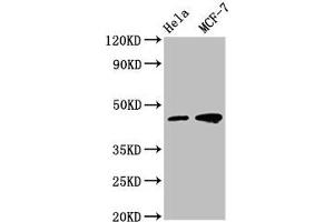 Western Blot Positive WB detected in: Hela whole cell lysate, MCF-7 whole cell lysate All lanes: TSG101 antibody at 1:500 Secondary Goat polyclonal to mouse IgG at 1/50000 dilution Predicted band size: 44, 32 KDa Observed band size: 44 KDa Exposure time:5 min (Tumor Suppressor Gene On Chromosome 11 (TSG11) (AA 1-145) 抗体)