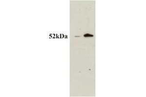 Western Blotting (WB) image for anti-ATP Synthase, H+ Transporting, Mitochondrial F1 Complex, beta Polypeptide (ATP5B) antibody (ABIN7581188)
