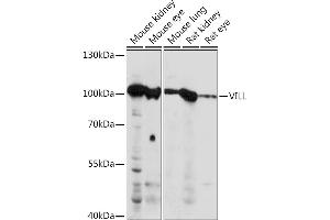 Western blot analysis of extracts of various cell lines, using VILL Rabbit pAb (ABIN7271325) at 1:1000 dilution. (VILL 抗体  (AA 637-856))