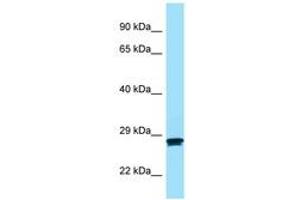Image no. 1 for anti-Melanocortin 2 Receptor (Adrenocorticotropic Hormone) (MC2R) (AA 86-135) antibody (ABIN6748408)