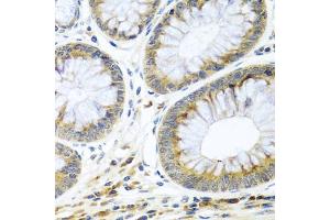 Immunohistochemistry of paraffin-embedded human colon using WNT9A antibody (ABIN5974646) at dilution of 1/100 (40x lens).