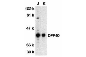 Western Blotting (WB) image for anti-DNA Fragmentation Factor, 40kDa, beta Polypeptide (Caspase-Activated DNase) (DFFB) (N-Term) antibody (ABIN1031351) (DFFB 抗体  (N-Term))