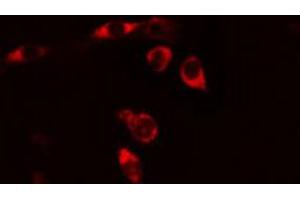 ABIN6269237 staining HeLa cells by IF/ICC. (CD130/gp130 抗体  (C-Term))