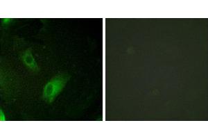 Peptide - +Immunohistochemistry analysis of paraffin-embedded human ovary tissue using IREB1 antibody. (Aconitase 1 抗体  (Internal Region))