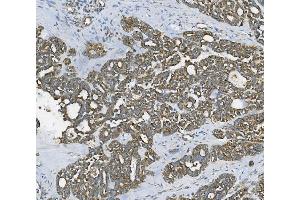 IHC analysis of RAB1B using anti-RAB1B antibody (ABIN7602809). (RAB1B 抗体  (C-Term))