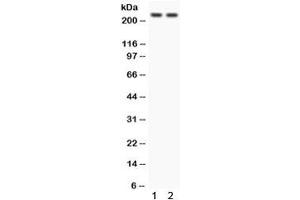 Western blot testing of 1) rat heart and 2) human 293 lysate with Otoferlin antibody. (Otoferlin 抗体)