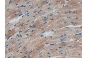 Detection of TXNRD1 in Mouse Heart Tissue using Polyclonal Antibody to Thioredoxin Reductase 1 (TXNRD1)