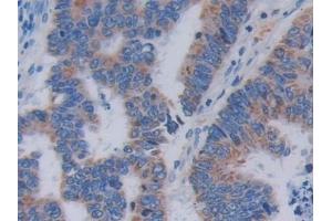 Immunohistochemistry (IHC) image for anti-Topoisomerase (DNA) III alpha (TOP3A) (AA 35-179) antibody (ABIN7435616)