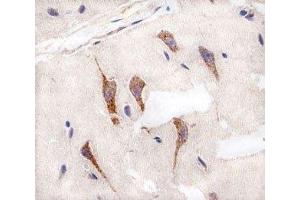 Immunohistochemical analysis of paraffin-embedded human brain using AURKA antibody at 1:25 dilution. (Aurora A 抗体)