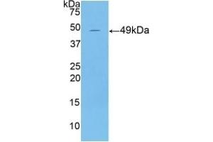 Detection of Recombinant KRT18, Mouse using Polyclonal Antibody to Cytokeratin 18 (CK18) (Cytokeratin 18 抗体  (AA 1-423))