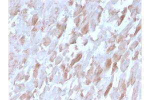 Formalin-fixed, paraffin-embedded human Cardiac Muscle stained with Sarcomeric Actinin Alpha 2 Mouse Monoclonal Antibody (ACTN2/3291). (ACTN2 抗体  (AA 557-692))