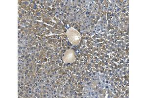 IHC analysis of Glycine decarboxylase/GLDC using anti-Glycine decarboxylase/GLDC antibody (ABIN7602073). (GLDC 抗体  (AA 574-1020))