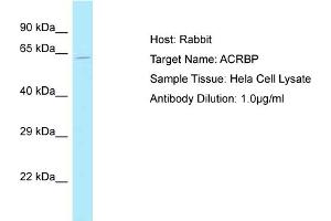 Host: Rabbit Target Name: ACRBP Sample Tissue: Human Hela Whole Cell Antibody Dilution: 1ug/ml (ACRBP 抗体  (N-Term))