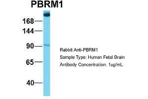 Host: Rabbit Target Name: NOP56 Sample Type: Human Fetal Brain Antibody Dilution: 1. (Polybromo 1 抗体  (Middle Region))