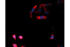 Immunofluorescence (IF) image for anti-Casein Kinase 1, delta (CSNK1D) (AA 1-409) antibody (APC) (ABIN5565290) (Casein Kinase 1 delta 抗体  (AA 1-409) (APC))