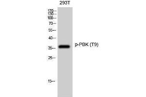 Western Blotting (WB) image for anti-PDZ Binding Kinase (PBK) (pThr9) antibody (ABIN3182227) (PBK 抗体  (pThr9))