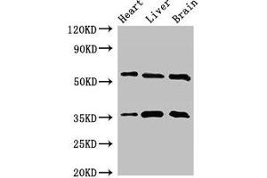 Western Blot Positive WB detected in: Mouse heart tissue, Mouse liver tissue, Mouse brain tissue All lanes: STK35 antibody at 2. (STK35 抗体  (AA 1-200))