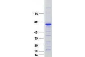 Validation with Western Blot (Tricellulin Protein (MARVELD2) (Transcript Variant 1) (Myc-DYKDDDDK Tag))