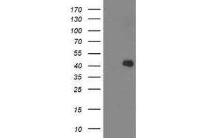 Western Blotting (WB) image for anti-Aldolase B, Fructose-Bisphosphate (ALDOB) antibody (ABIN1496607) (ALDOB 抗体)