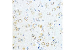 Immunohistochemistry of paraffin-embedded mouse brain using Aromatase (CYP19) antibody  at dilution of 1:100 (40x lens).