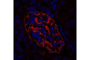 Immunostaining of a paraffin embedded mouse kidney section (dilution 1 : 200; red). (SYNPO 抗体  (Isoform 2))