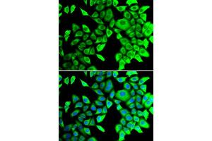 Immunofluorescence analysis of A549 cells using THADA antibody. (THADA 抗体)