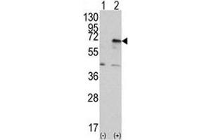 Western blot analysis of PRKR antibody and 293 cell lysate (2 ug/lane) either nontransfected (Lane 1) or transiently transfected with the EIF2AK2/PKR gene (2). (EIF2AK2 抗体  (AA 519-550))