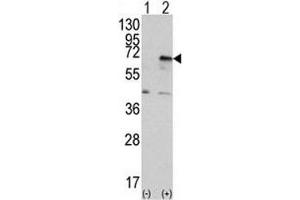 Western blot analysis of PRKR antibody and 293 cell lysate (2 ug/lane) either nontransfected (Lane 1) or transiently transfected with the EIF2AK2/PKR gene (2).