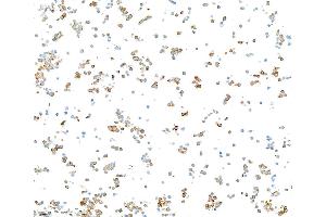 Immunocytochemistry (ICC) image for anti-Neurofilament, Light Polypeptide (NEFL) (AA 150-200) antibody (ABIN7453980)