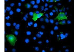 Anti-TOMM34 mouse monoclonal antibody (ABIN2454737) immunofluorescent staining of COS7 cells transiently transfected by pCMV6-ENTRY TOMM34 (RC201083). (TOMM34 抗体)