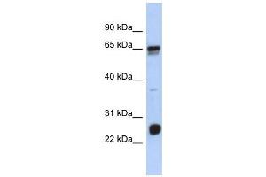 C1ORF103 antibody used at 1 ug/ml to detect target protein. (C1orf103 抗体  (N-Term))