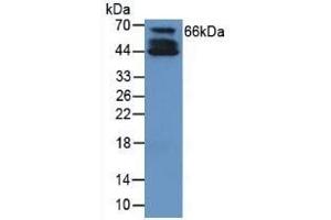 Detection of COL10 in Human Cartilage Tissue using Polyclonal Antibody to Collagen Type X (COL10) (COL10 抗体  (AA 547-680))