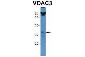 Host:  Rabbit  Target Name:  VDAC3  Sample Type:  HT1080  Antibody Dilution:  1. (VDAC3 抗体  (N-Term))