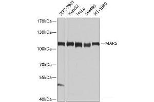 Western blot analysis of extracts of various cell lines using MARS Polyclonal Antibody at dilution of 1:1000. (Mars (MARS) 抗体)
