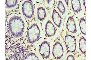 Immunohistochemistry of paraffin-embedded human colon tissue using ABIN7155860 at dilution of 1:100 (VENTX 抗体  (AA 1-258))