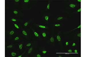 Immunofluorescence (IF) image for anti-General Transcription Factor IIIC, Polypeptide 2, beta 110kDa (GTF3C2) (AA 1-911) antibody (ABIN947948)